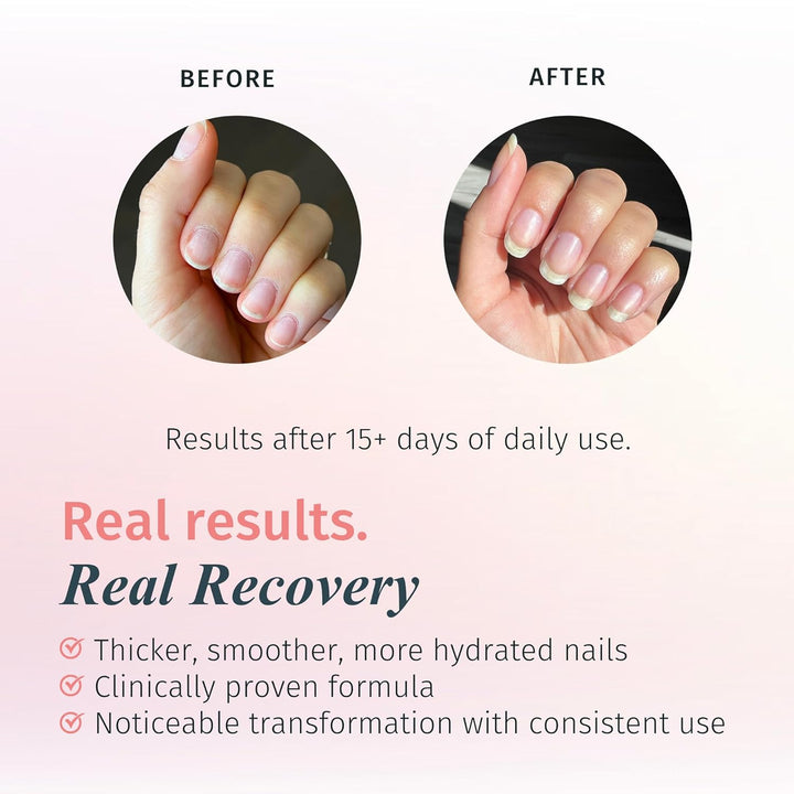 Rejuvacote 1 Nail Growth System - Maximum Strength | Nail Strengthener for Damaged Nails from Gel, Acrylic Manicure | Grow Long Natural Fingernails Fast - 0.45 Fl. Oz.