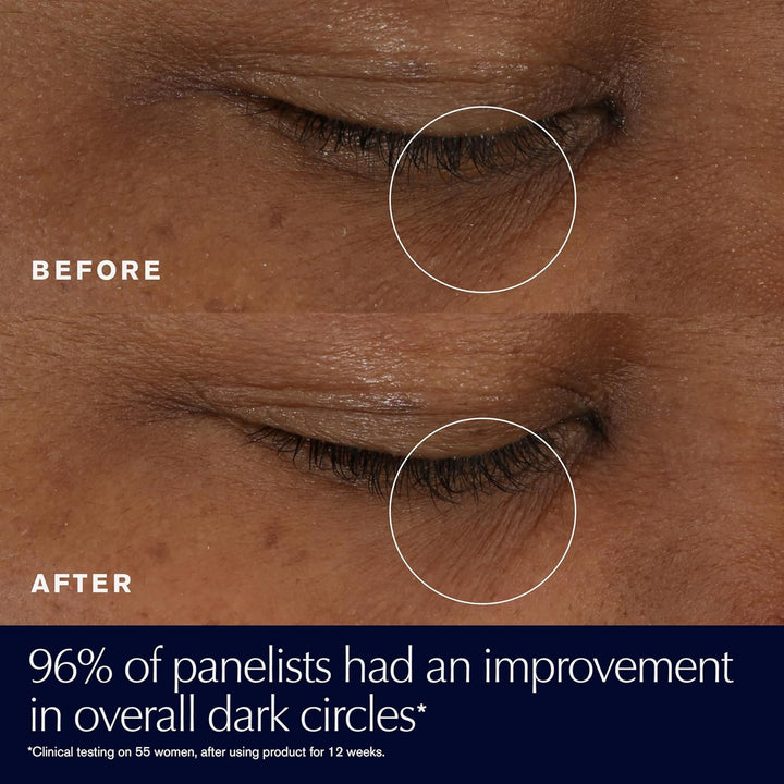 Advanced Night Repair Eye Supercharged Gel-Cream Synchronized Multi-Recovery | under Eye Cream for Dark Circles