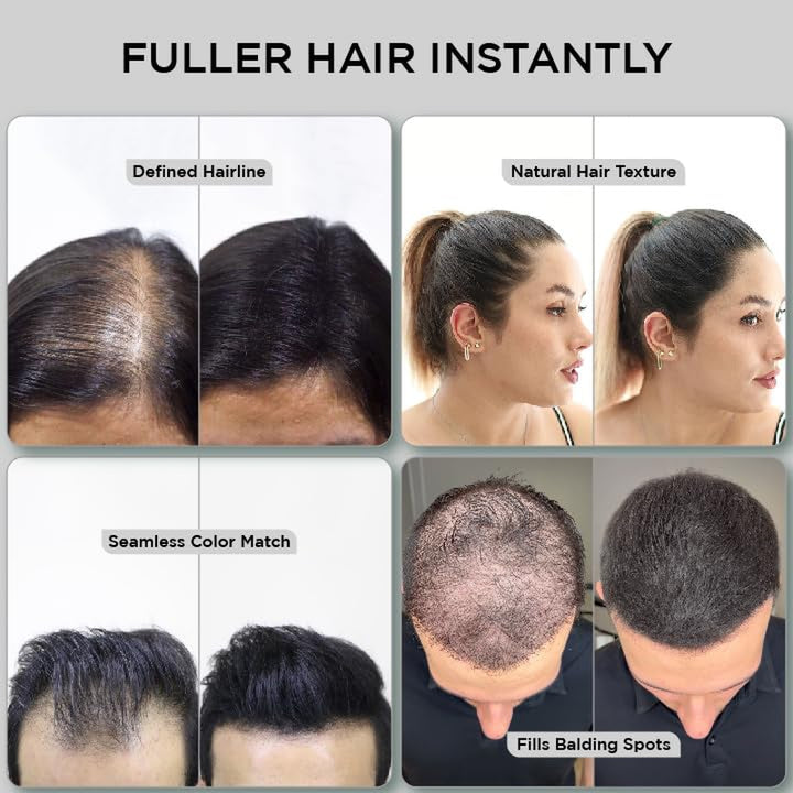 Hair Fibers for Thinning Hair & Bald Spots (BLACK) - 25G Bottle - Conceals Hair Loss in Seconds - Hair Powder for Women & Men