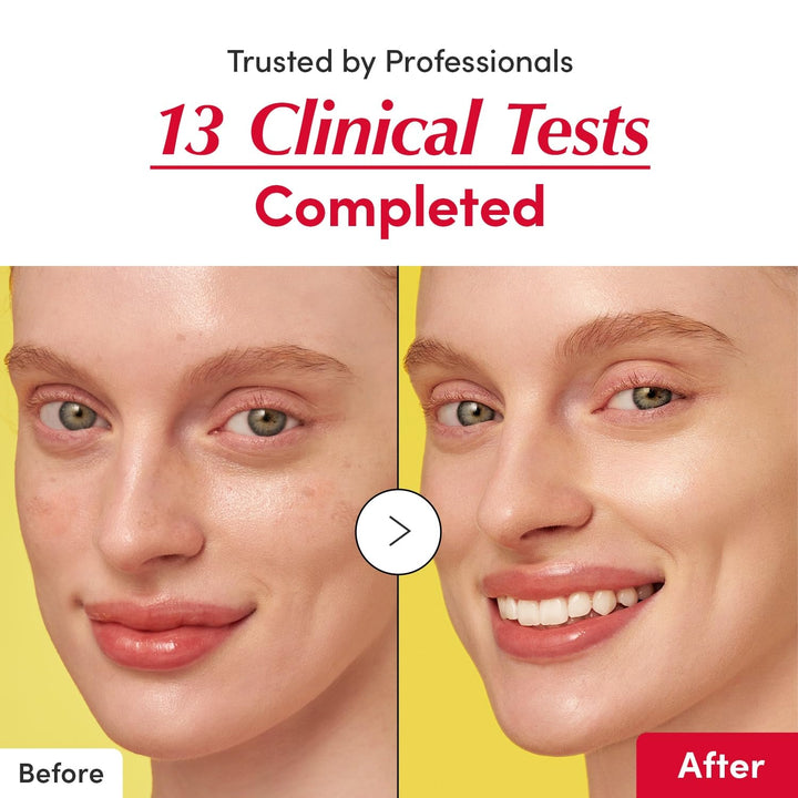 Vitamin Illuminating Serum – Brightening Vitamin C Serum with Niacinamide | Strengthens Skin Barrier | Hydrates Using Ceramide and Hyaluronic Acid, 1.01Oz / 30Ml