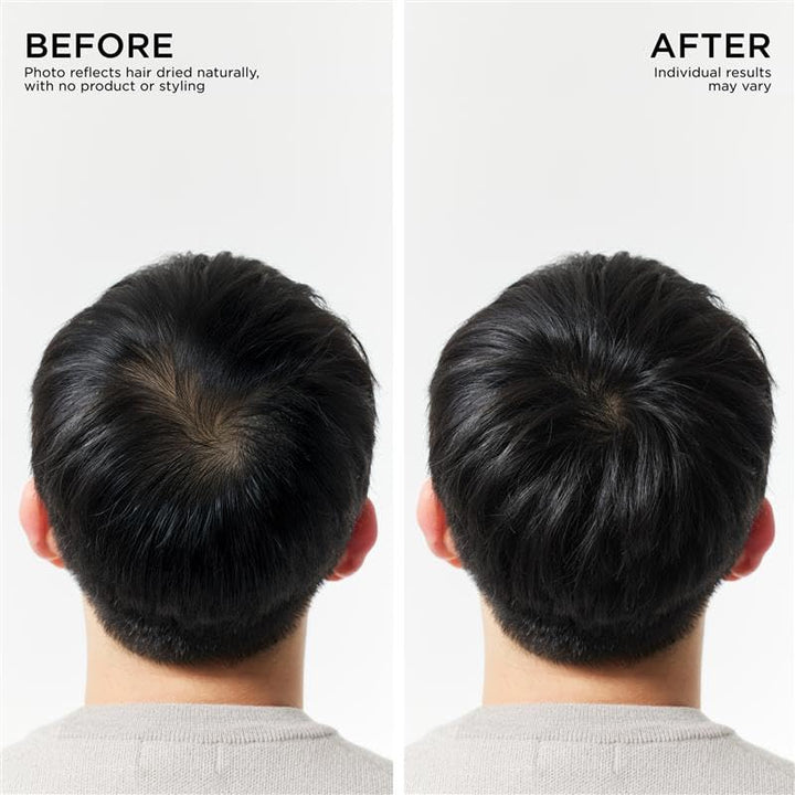 Hair Thickening Conditioner for Hair Loss, Thinning Hair, Korean Hair Care, Biotin Scalp Treatment, Clinically Tested, Thicker Hair, Reduces Oil