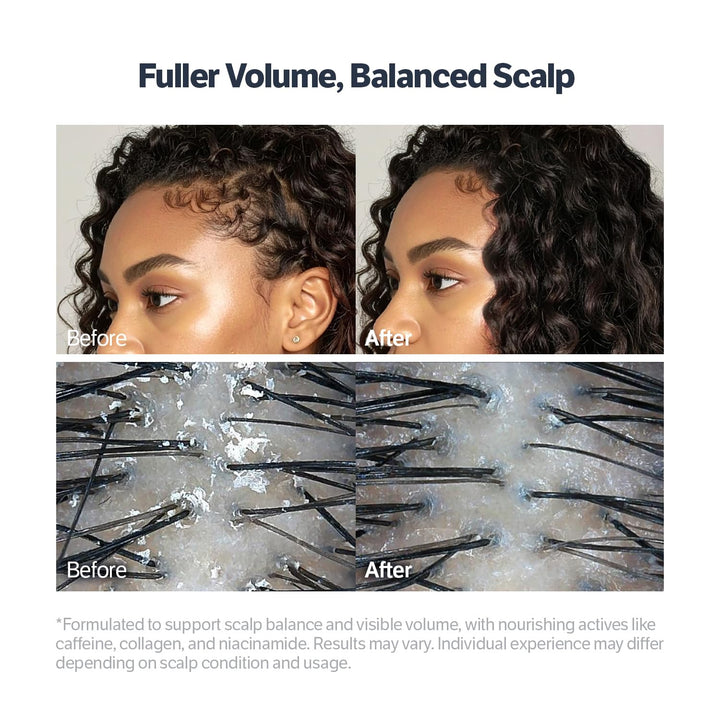 Deep Collagen Retinol Power Boosting Scalp Serum | Roll on Hair Growth, Hair Thickening Serum, Itchy & Dry Scalp Treatment, Caffeine, Biotin, Rosemary – Korean Hair Care, 0.5 Fl Oz