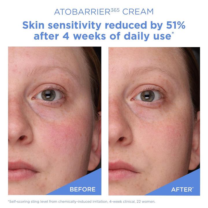 ATOBARRIER365 Cream with Ceramides, Korean Face Moisturizer for Barrier Repair | 120H Lasting Hydration, Ceramide Capsules, Dry & Sensitive Skin, Non-Comedogenic, 80 Ml / 2.70 Fl.Oz.