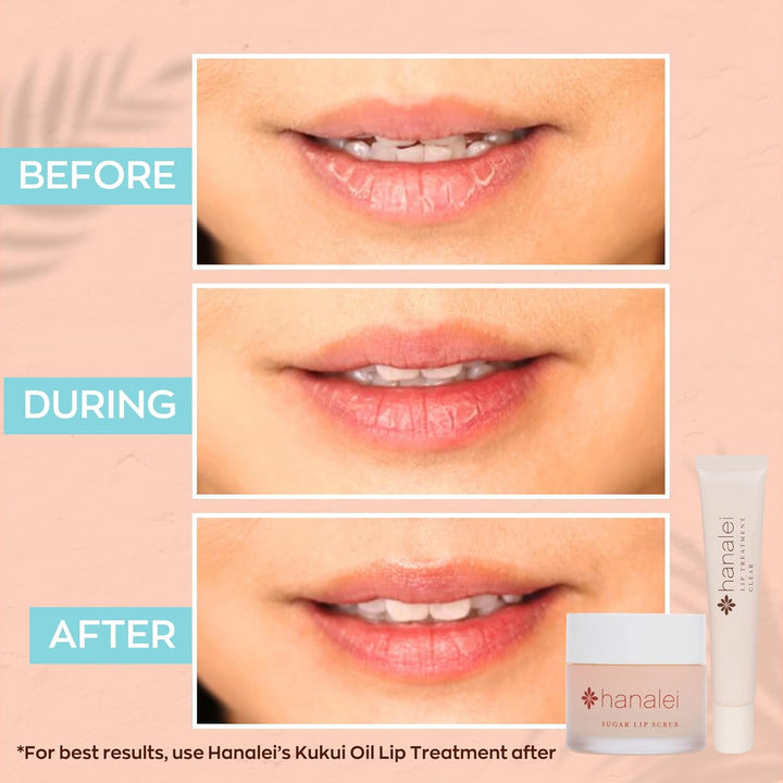 Vegan Sugar Lip Scrub Exfoliator - Hawaiian Cane Sugar, Kukui Oil & Shea Butter for Smooth, Hydrated Lips - Natural, Cruelty-Free Lip Care, Removes Dry Skin, Moisturizes & Softens (22G)