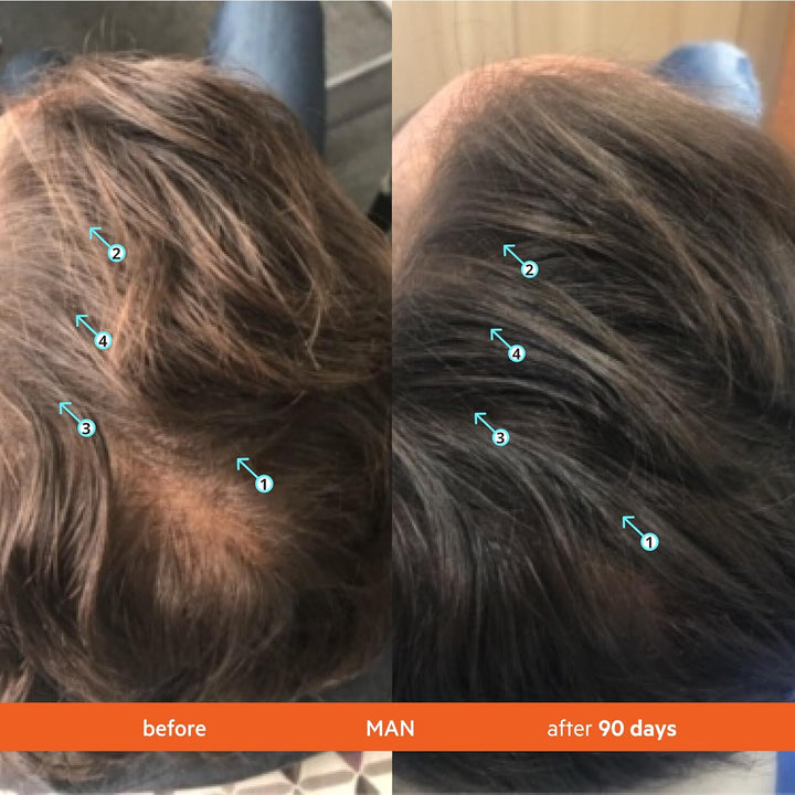 DS Labs Revita Conditioner, 205Ml - Lightweight, Scalp First Hydration for Fuller Looking, Softer Hair, Thickening Appearance, Sulfate & Silicone Free, Color Safe, for Men & Women