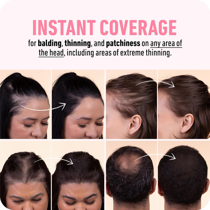 Hairline Powder - Root Touch up Hair Color for Gray Coverage - Bald Spot Concealing Hair Powder for Women & Men - 48-Hour Stain-Proof - Dark Brown