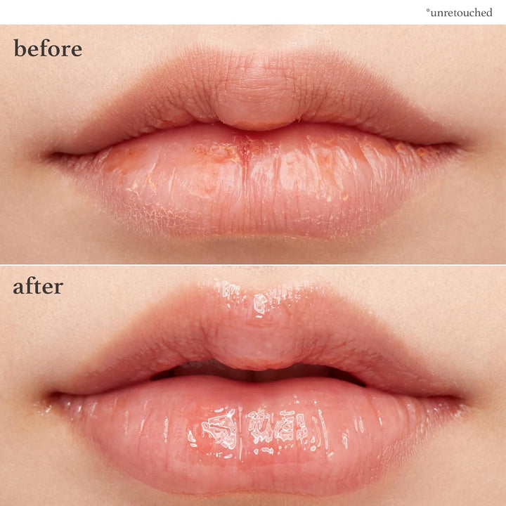 Vegan Applebutter Lip Mask Overnight – Hydrating Lip Balm & Butter with Shea Butter & Vitamins | Soothing Moisturizer, Softening Treatment for Dry Lips, 0.42 Oz