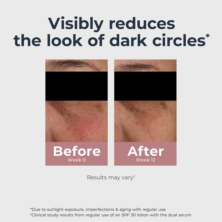 Radiant Tone Eye Cream Dark Circle Corrector, Eye Brightening Cream with Thiamidol and Hyaluronic Acid, Helps Reduce the Look of Eye Puffiness, 0.5 Oz Tube