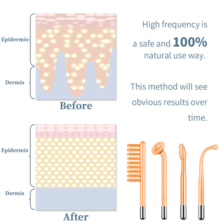 High Frequency Facial Machine -  Portable Handheld High Frequency Facial Skin Wand Machine with 4 Different Tubes