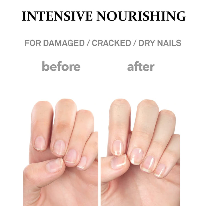 Silk Repair Nail Cream - Intensive Nail & Cuticle Hydration with Silk-Fibroin - Non Oily Formula - for Dry & Damaged Nails - Gel Nail Recovery, 15Ml (0.5 Fl. Oz.)