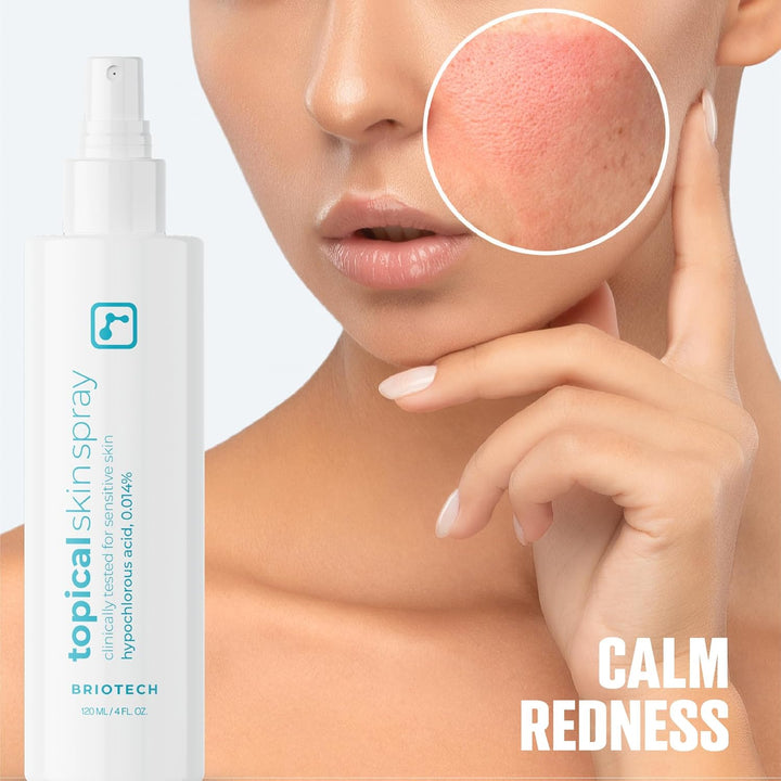 Topical Skin Spray, Hypochlorous Acid Spray for Sensitive Skin, Hocl Facial Mist, Full Body Support against Irritation, Calm Redness, Soothe Foot & Scalp, 8 Oz (1 Pack)