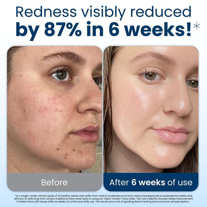 Clean Towels XL®, 100% USDA Biobased Face Towel, Disposable Face Towelette, Eczema Association Accepted, Makeup Remover Dry Wipes, Ultra Soft, 1 Pack, 50 Ct