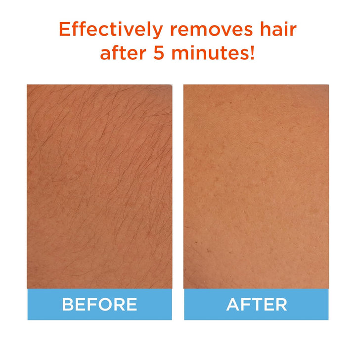 Hair Remover Face 1.6 Fl Oz + Aftercare Lotion 0.67 Fl Oz (Pack of 1)