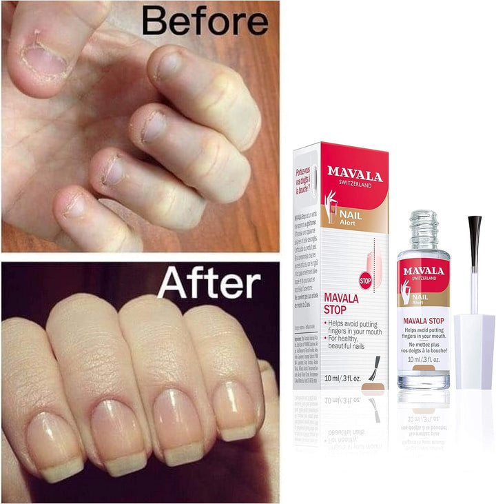 Stop Deterrent Nail Polish Treatment | Nail Care to Help Stop Putting Fingers in Your Mouth | Bitter Taste | Easy Application | for Ages 3+ | 0.3 Fl Oz