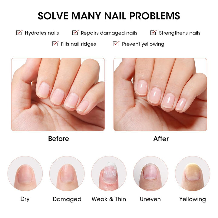 Clear Nail Polish Ridge Filling Base Coat, Nail Strengthener and Growth, Ridge Filler for Nails, Hydrate Strengthen Nourish Damaged Dry Natural Nails, Shea Butter & Vitamin E & Protein Formula
