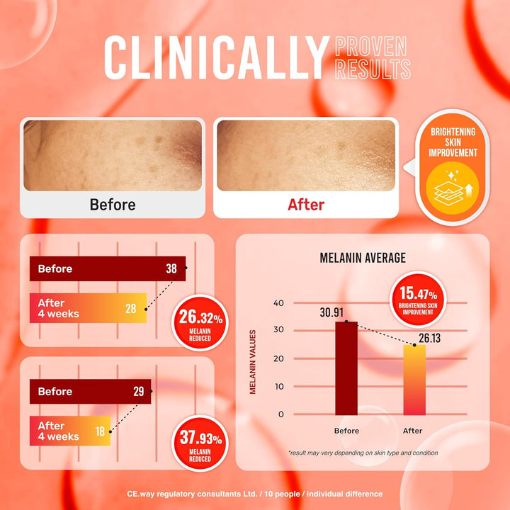 Pure Kojic Acid Soap | Glycerin Soap Bar for Gentle Skin Brightening and Exfoliation with Tea Tree, Coconut Oil, Hyaluronic Acid & Vitamin C, Vegan, 2.82 Oz