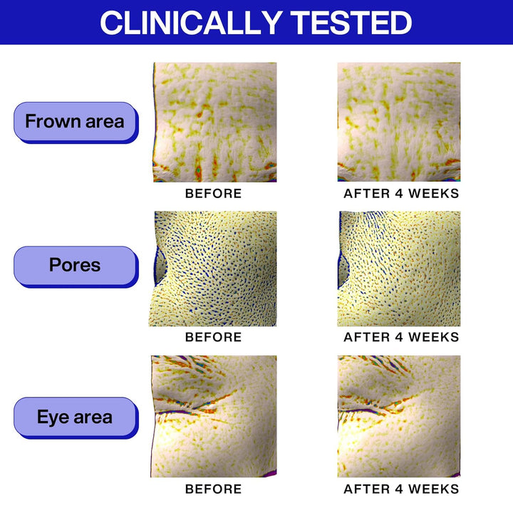 Retinol Super Bounce Serum | Korean Retinoid Eye Treatment for Anti-Aging, Beginner Friendly, Reduction in Fine Lines & Wrinkles, Firming and Rejuvenating, Daily Glow Routine, 1.01 Fl Oz.