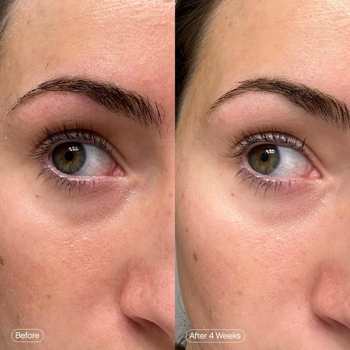Faded Brightening under Eye Masks | Revitalizing Patches to Depuff, Hydrate, and Illuminate | Diminishes Dark Circles and Fine Lines | Made with Kojic Acid, Caffeine & Niacinamide