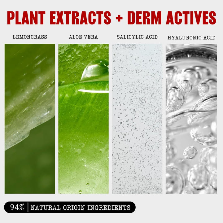 Blemish Clearing Salicylic Acid Toner, Acne Treatment Face Toner with 2% Salicylic Acid, Soothing and Non-Stripping Skin Care, 12 Fl Oz