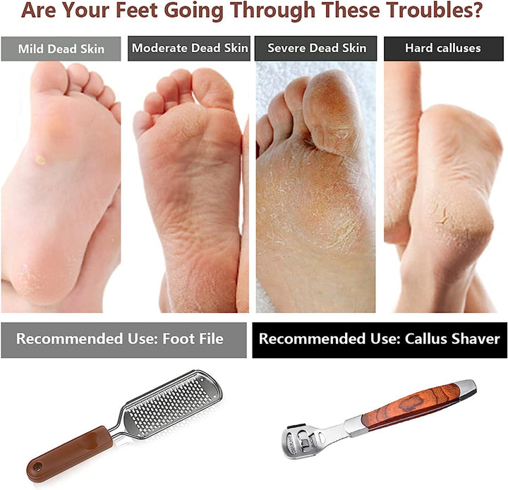 Colossal Foot Rasp & Wood Handle Callus Shaver (10 Replacement & 1 File Foot Heads), Pedicure Foot File Kit, Heel Scraper for Feet, Foot File Callus Remover