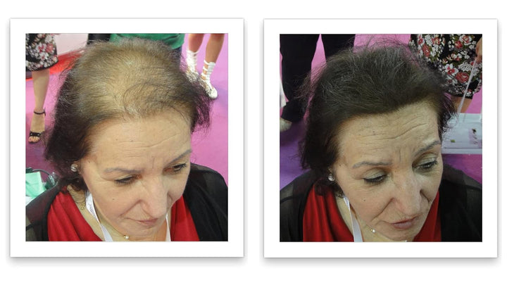 Hair Loss Concealer, 90-Day Supply, Dark Brown