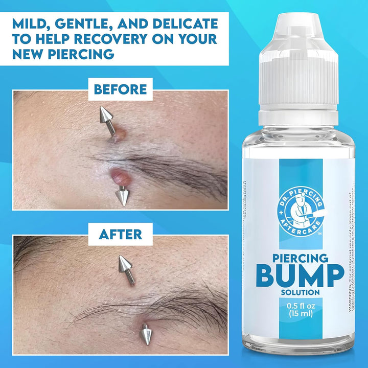 Keloid Drops – Non-Greasy Saline Solution for Keloid Bump Removal for Piercings - May Reduce Appearance of Nose Piercing Bump, Nose Ear Lip Belly (15 Ml)