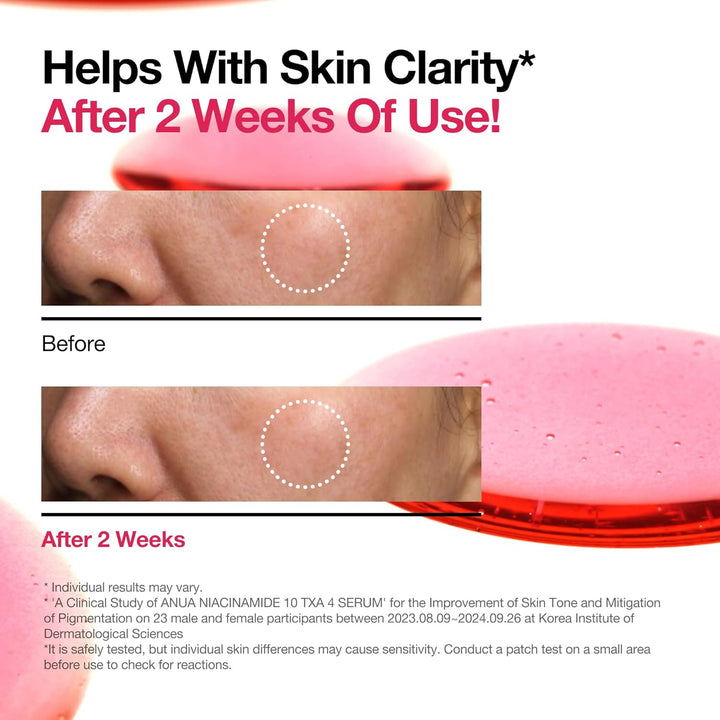 Niacinamide 10 + TXA 4 Serum, Hyaluronic Acid, Tranexamic Acid, Facial Serum for Glass Skin, Clarifying, Radiant Complexion with Natural Color, Korean Skin Care (30Ml /1.01 Fl.Oz)