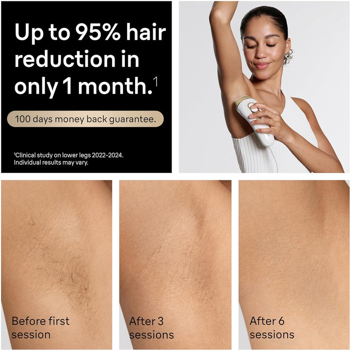 IPL Silk·Expert Pro 5 PL5157 Latest Generation IPL, Permanent Visible Hair Reduction, Holiday Gifts for Women and Men, At-Home Hair Removal System with Soft Pouch and Precision Head