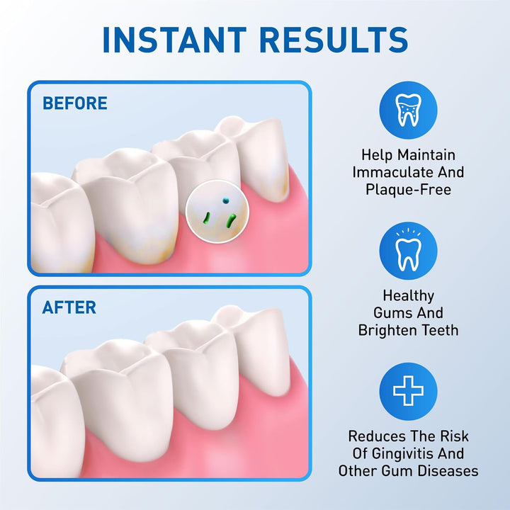Water Flosser Replacement Tips for Waterpik, Replacement Heads for Waterpik (6 Classic Jet Tips)