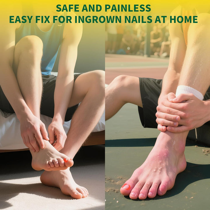 Large Size-Titanium Alloy Ingrown Toenail Treatment & Removal Kit for Quick Relief, Ingrown Toenail Removal Kit， Professional Ingrown Toenail Corrector, Ingrown Toenail Tools for Quick Relief, 10 Pcs