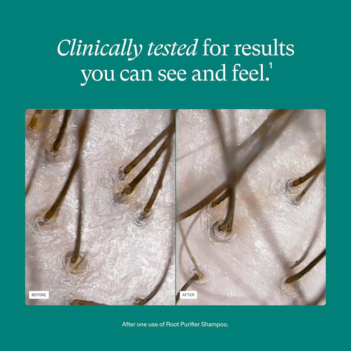 Shampoo, Cleanse and Hydrate Hair and Scalp, Improves Hair Volume, Strength and Texture, Physician-Formulated for Thinning Hair, Color Safe, Sulfate Free