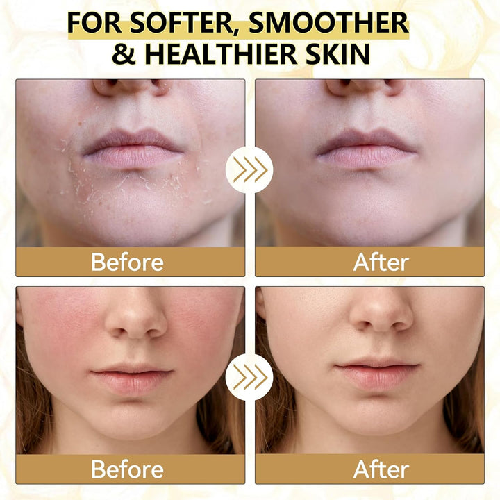 Beef Tallow for Skin, Organic Whipped Tallow and Honey Balm, Grass Fed Beef Tallow Face Moisturizer, Natural Tallow Skin Care Cream Body Butter, Nourish and Soothe Dry Skin