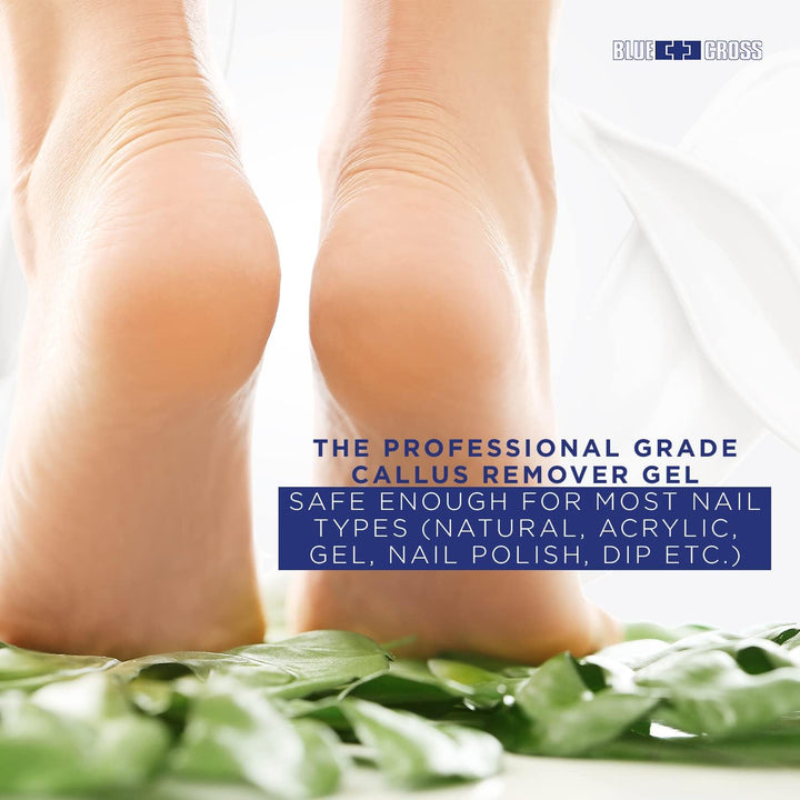 Callus Remover Gel for Feet or Heel, Extra Strength Professional Nail Care, File, Shaver, Scrubber & Pumice Stone Alternative for at Home Manicure/Pedicure Results, 6Oz