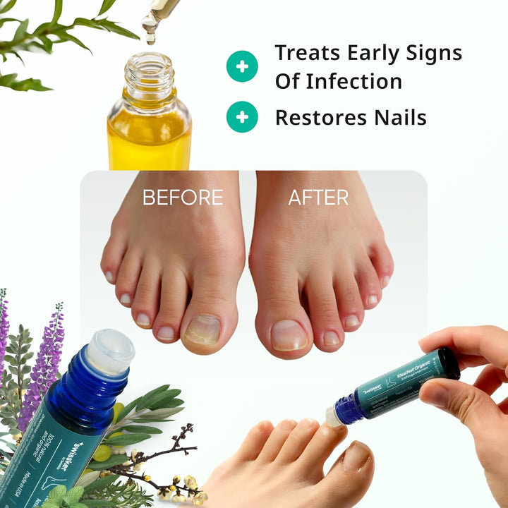 Klearnail Toenail Stick | Medi-Care Treatment | Natural Solution for Healthy Nails I Suitable for Foot, Toe, and Fingernail I for Brittle Toenails – 10Ml / 0.3 Fl. Oz. Pack 1 - Made in USA