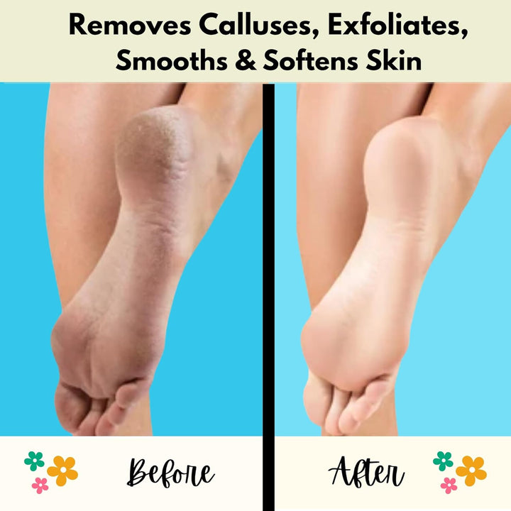 Pumice Callus Remover PUMI Bar: Pedicure Stone & Foot/Heel Scrubber - Medium Grit (Assorted Colors) 4 Pack