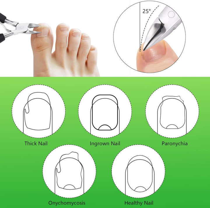 Heavy Duty Ingrown Toenail Clippers, Professional Toenails Trimmer, Podiatrist Toe Nail Clippers for Thick Nail & Ingrown Toenails, Sharp Curved Blade, Pedicure Tools.