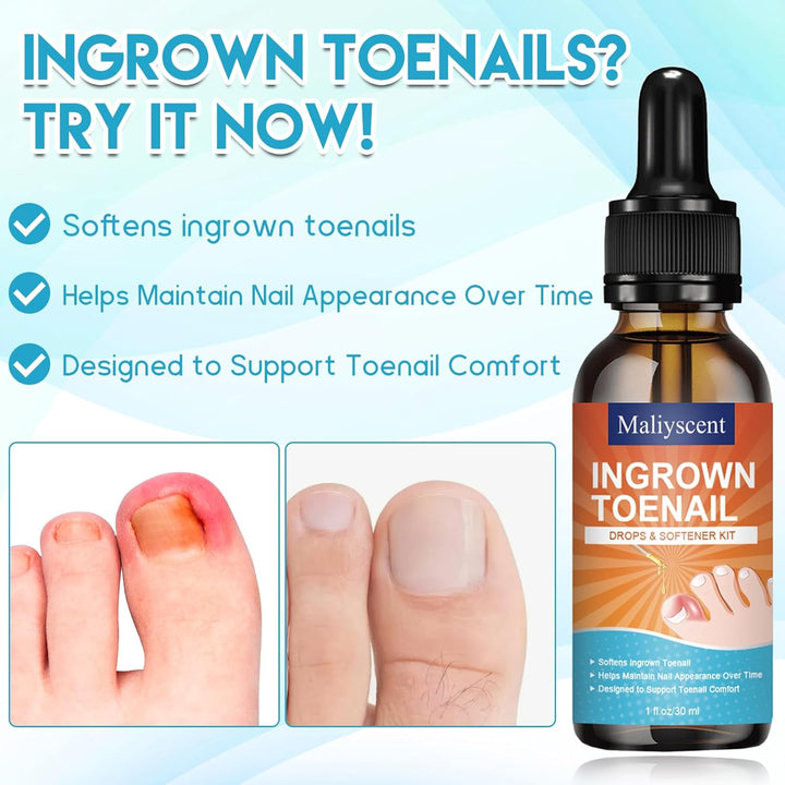 Ingrown Toenail Removal Kit, Professional Ingrown Toenail Tool Kit Includes Ingrown Toenail Corrector Drops, Corrector Patch, Toenail Clipper, Nail File Lifter Pedicure Tools