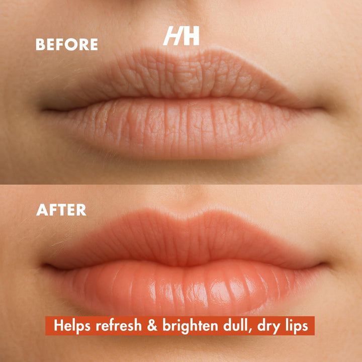 Turmeric Lip Scrub with Vitamin C – 100% Natural Vegan Exfoliant for Dark Dry Chapped Lips – Deep Conditioning Sugar Polish 1Oz