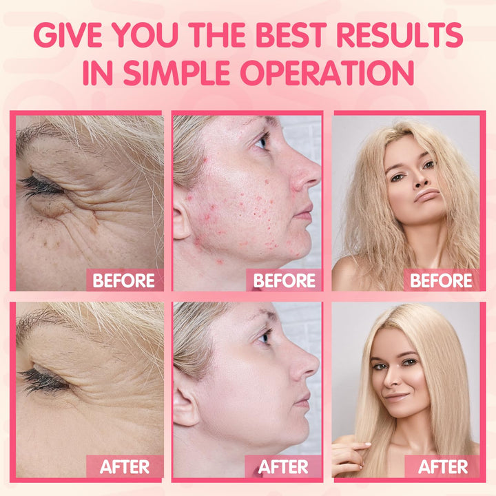 Portable High Frequency Facial Machine - Orange High Frequency Face Skin Wand Device