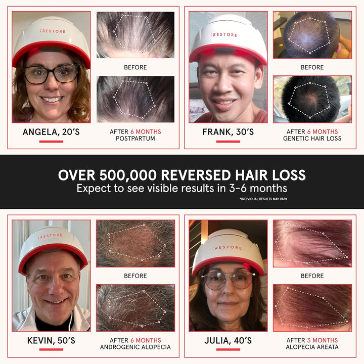 Professional Laser Red Light Therapy for Hair Growth System - FDA Cleared Hair Loss, Hair Thinning & Alopecia Treatment for Men & Women - 282 Lasers & Leds