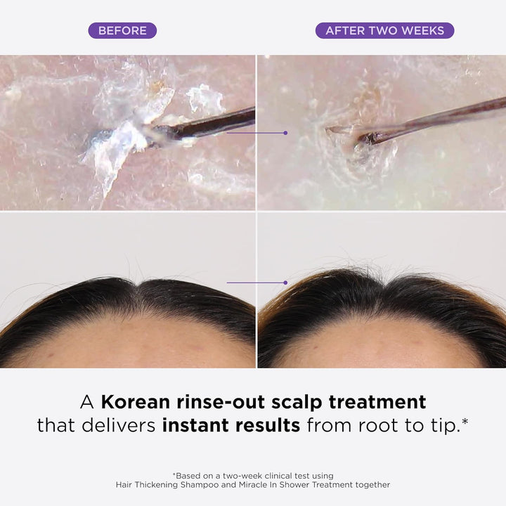 Miracle in Shower Treatment, Korean Hair Care, 5 Seconds to Smooth Hair, Rosemary Oil for Healthier-Looking Hair, Hair Rinse, Moisturizing Hair Treatment, Kbeauty Scalp Revitalizing Solution