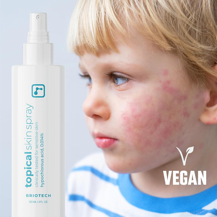 Topical Skin Spray, Hypochlorous Acid Spray for Sensitive Skin, Hocl Facial Mist, Full Body Support against Irritation, Calm Redness, Soothe Foot & Scalp, 8 Oz (1 Pack)