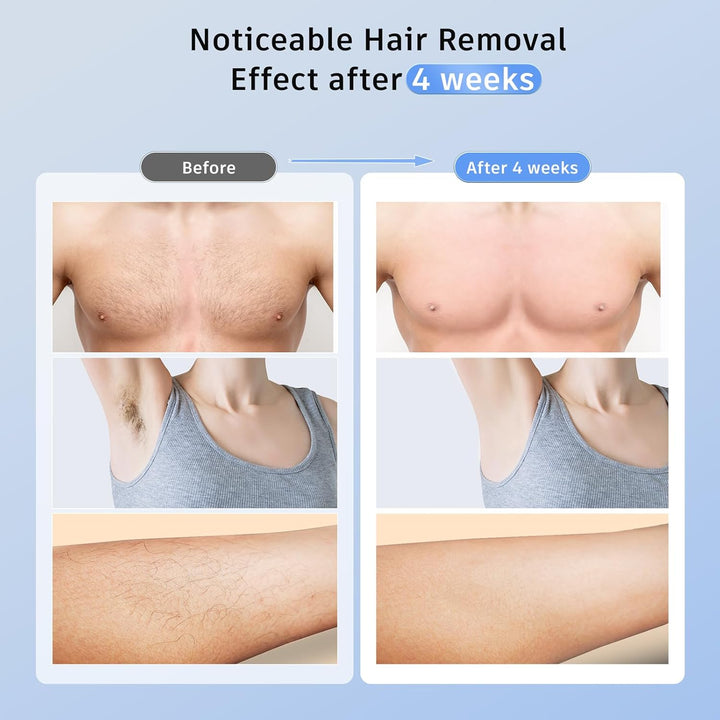 Laser Hair Removal  IPL Hair Removal Device with 5℃ Ice Cooling, 3 in 1 Painless Hair Removal for Women Men Permanent Face Body Beauty Care (Gold)