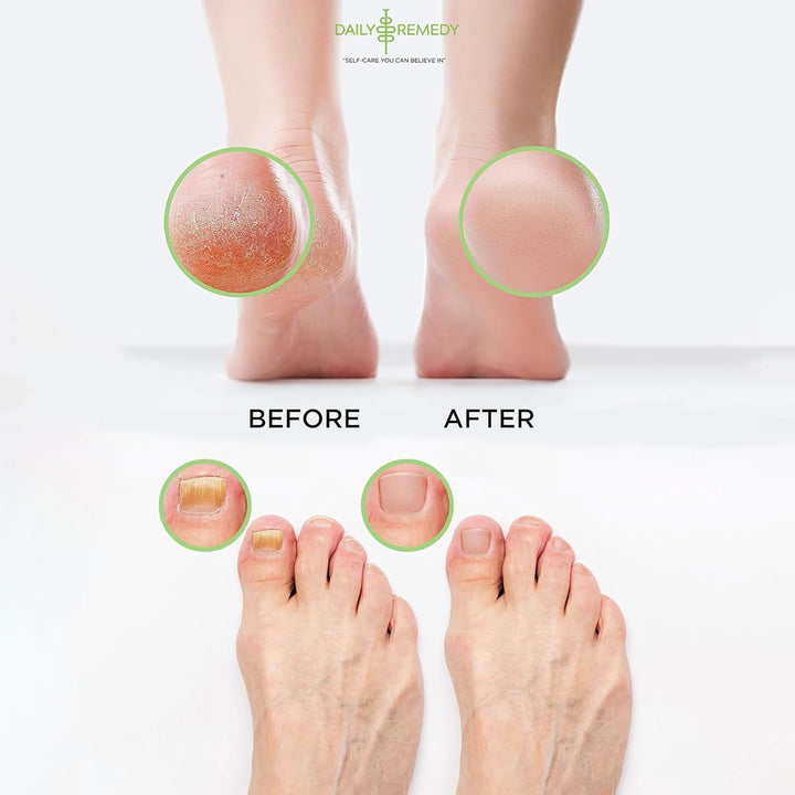 Foot Soak Salts- Variety Pack of 4- Tea Tree Oil, Muscle Relief, Calming Lavender & Citrus Soak- for Foot Pain, Soreness, Athlete’S Foot, Odors, Calluses-Made in USA