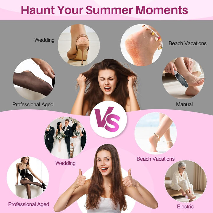 Electric Foot Callus Remover: Adjustable Speed Foot File for Cracked Heels - Working Women'S Summer Pedicure Tool with 60Pcs Sandpaper Discs - Dead Skin Remover for Dry Feet At-Home