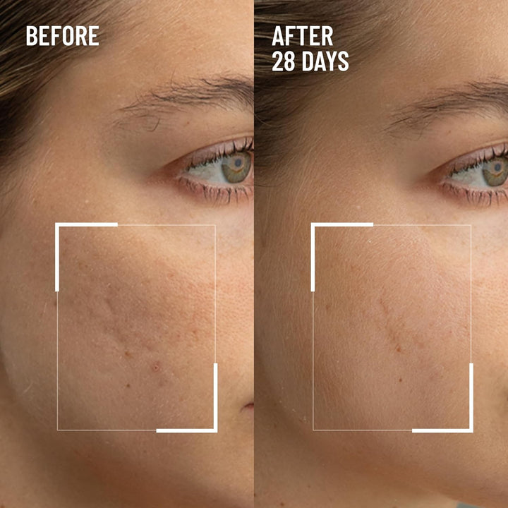 Dr. Brandt Microdermabrasion Renewing Face Exfoliator - Reduces Dull Skin, Uneven Texture, Fine Lines, Acne Scars & Wrinkles - 2.0 Oz