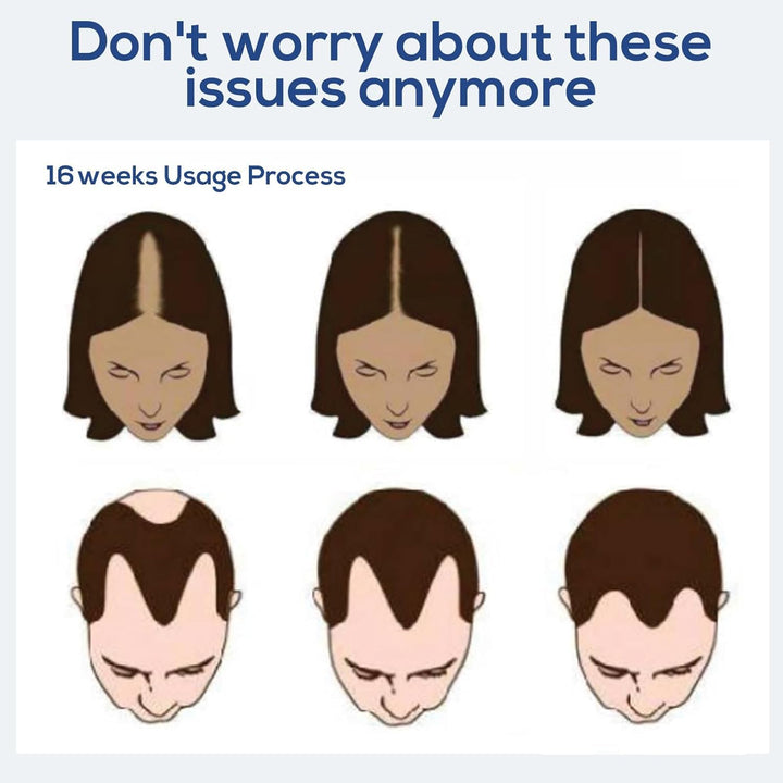 Laser Therapy Hair Growth Comb,Model: Lasercomb-001, Promote Hair Growth in Women and Men,Laser Comb Is a Hand-Held Comb-Shaped Low Level Laser Therapy Device