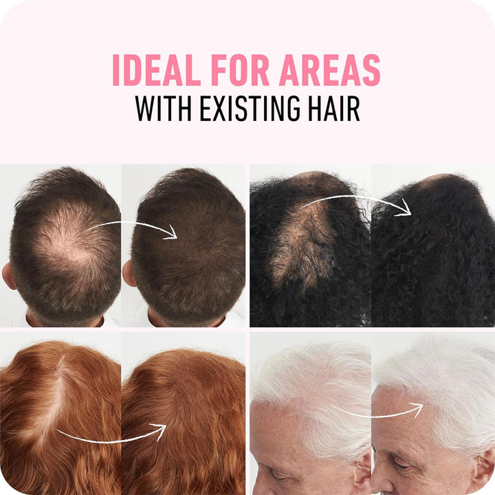 Hair Fibers (28G) - Fill in Thinning and Fine Hair for an Instantly Fuller, Thicker Look - 14 Shades for Women & Men - Dark Brown