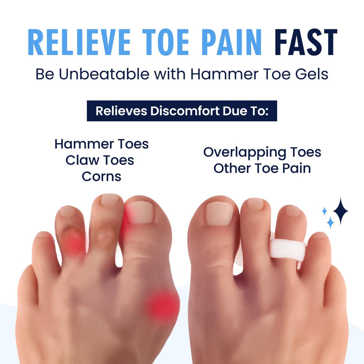 Hammer Toe Gels - 2 Pairs - Hammertoe Support Crest for Women & Men - Cushion & Temporary Splint for Toe Alignment, Crooked Toes, and Pain Relief - White - 1 Loop Design