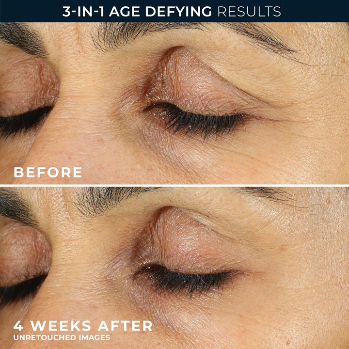 Retinol Correxion Eye Cream Mini for Dark Circles & Puffiness, Daily Wrinkle Cream, anti Aging Line Smoothing Skin Care Treatment, .25 Ounces